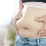Medical Weight Loss
